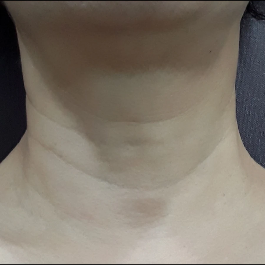 Before view for case 04