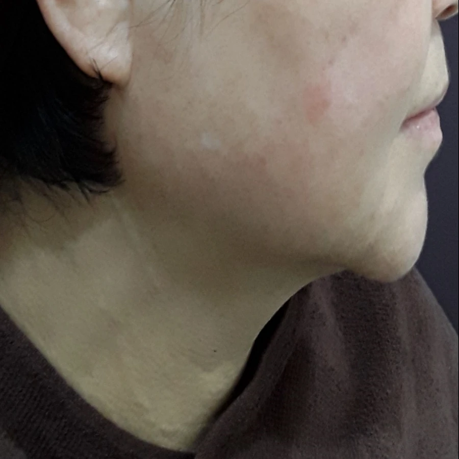 After view for case 03